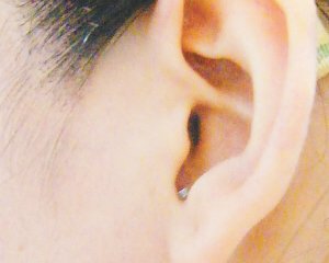 中耳炎患者應該注意的